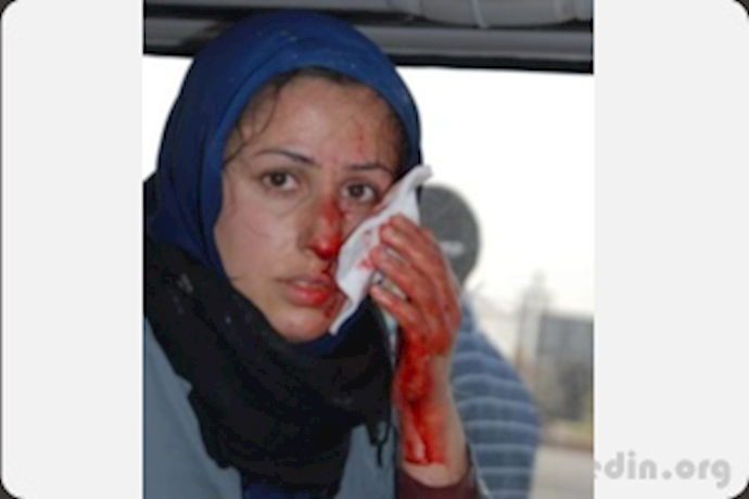یک مجاهد مجروح، در جریان حمله اوباش عراقی خامنه‌ای به اشرف