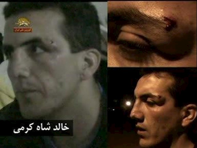 مجروح حمله به اشرف - خالد شاه کرمی