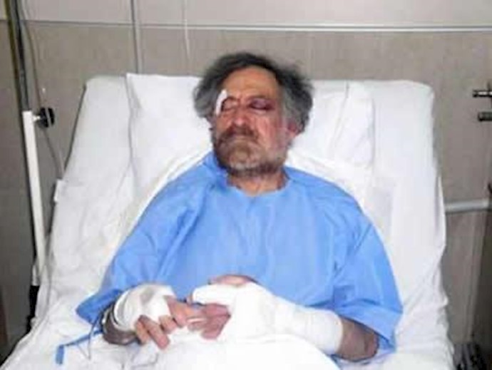 علی فرزات پس از حمله وحشیانه لباس شخصی ها