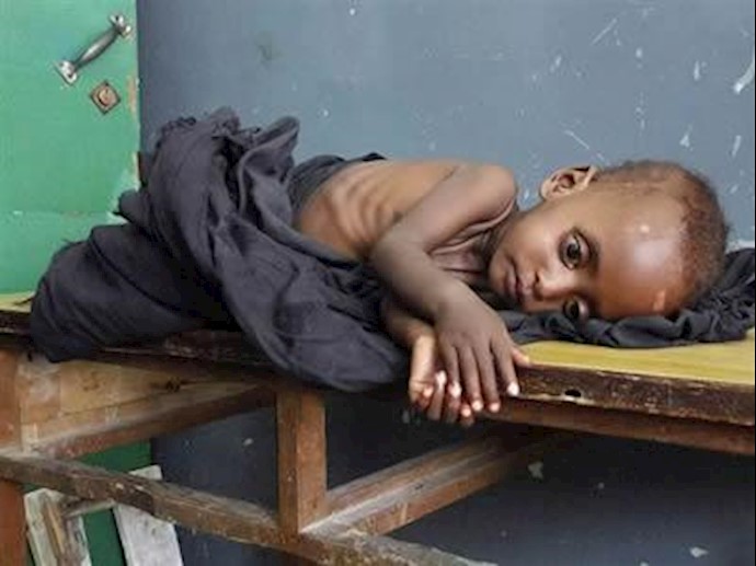نیمی از جمعیت سومالی از قحطی رنج می‌برند