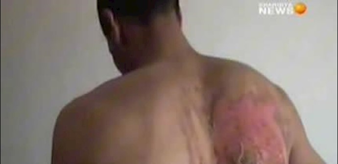 شکنجه زندانیان در سیاهچالهای نوری مالکی