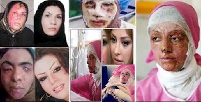 اسید پاشی در ایران 