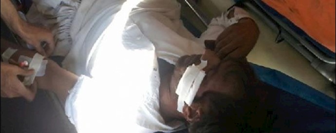 به رگبار بستن خودرو