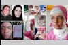 قربانیان اسید پاشی