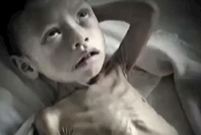 عواقب ناامنی غذایی در ایران