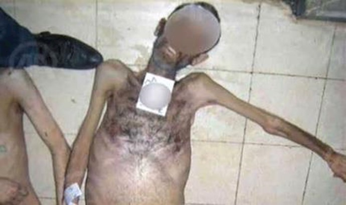 شکنجه توسط جنایتکاران رژیم اسد