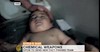 حمله به حما توسط گاز کلر