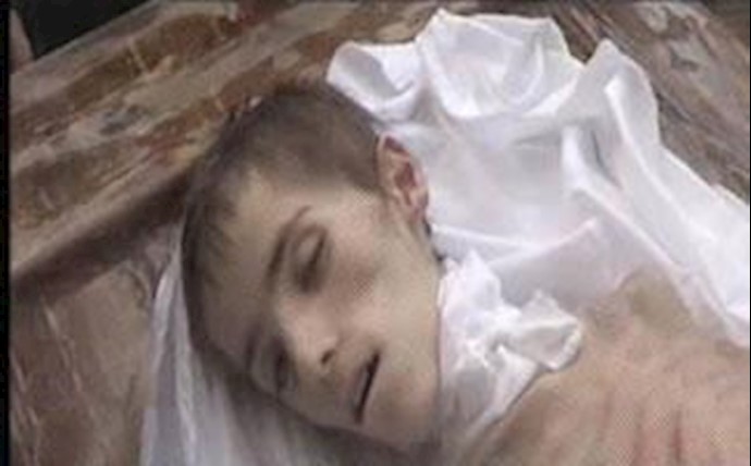 محاصره و گرسنگی دادن مردم مضايا توسط  رژیم بشار اسد 