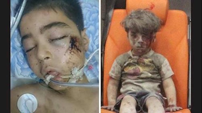 علی برادر عمران کودک سوری که جهانی را بر انگیخت در اثر شدت جراحات درگذشت