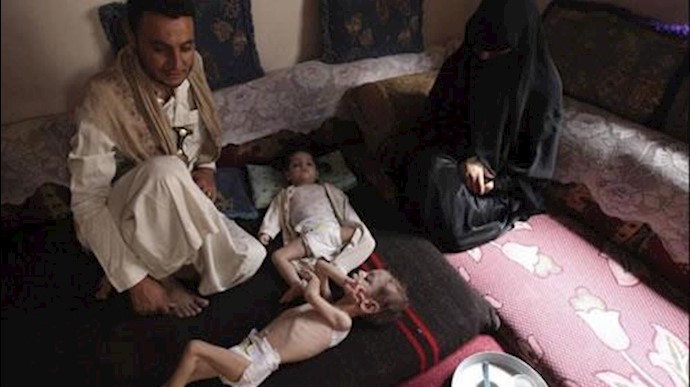 وضعیت وخیم کودکان یمنی 