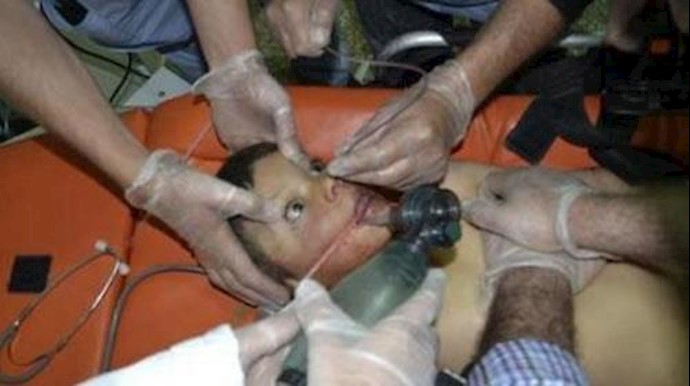 نشانه‌های تنفس «گاز اعصاب»بر روی قربا نیان جنایت شیمیا یی اسد 