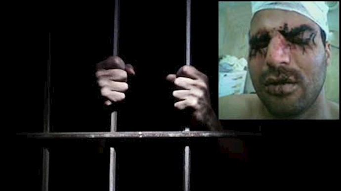 دوختن لب و چشم اعتراضی در زندان دیزل‌آباد کرمانشاه