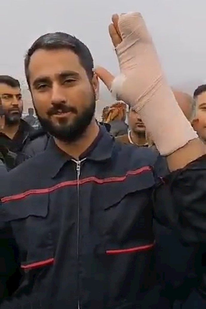 یکی از کارگران که مورد ضرب ‌و شتم نیروهای سرکوبگر رژیم قرار گرفته است