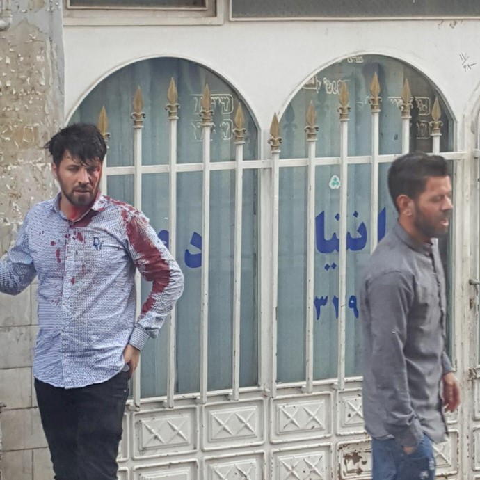 شلیک با تفنگ ساچمه‌ای به تظاهر کنندگان و زخمی شدن جوانان در تهران ۵تیر۹۷