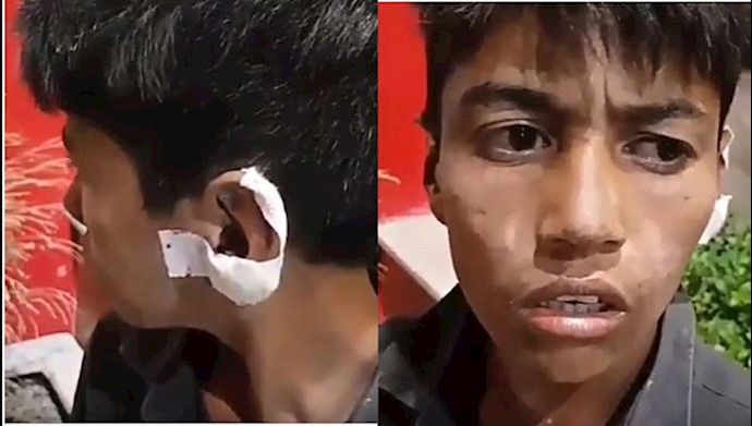 بریدن گوش کودک کار توسط ماموران شهردای در تهران