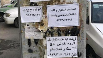 فروش اعضای بدن در ایران