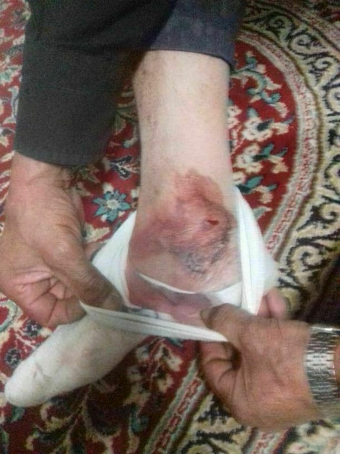 -روستای کردآباد استان یزد عکس مجروحان