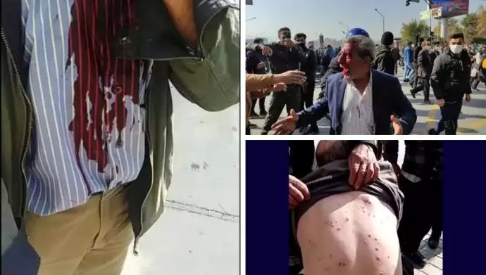 مصدومین خیزش مردم و کشاورزان اصفهان توسط سلاحهای ساچمه‌ای یگان ویژه
