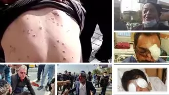 شلیک به معترضان اصفهانی با سلاحهای ساچمه‌ای نیروهای یگان ویژه رژیم