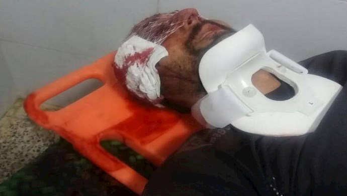 بصیر احمدزاده در بیمارستان کرمانشاه