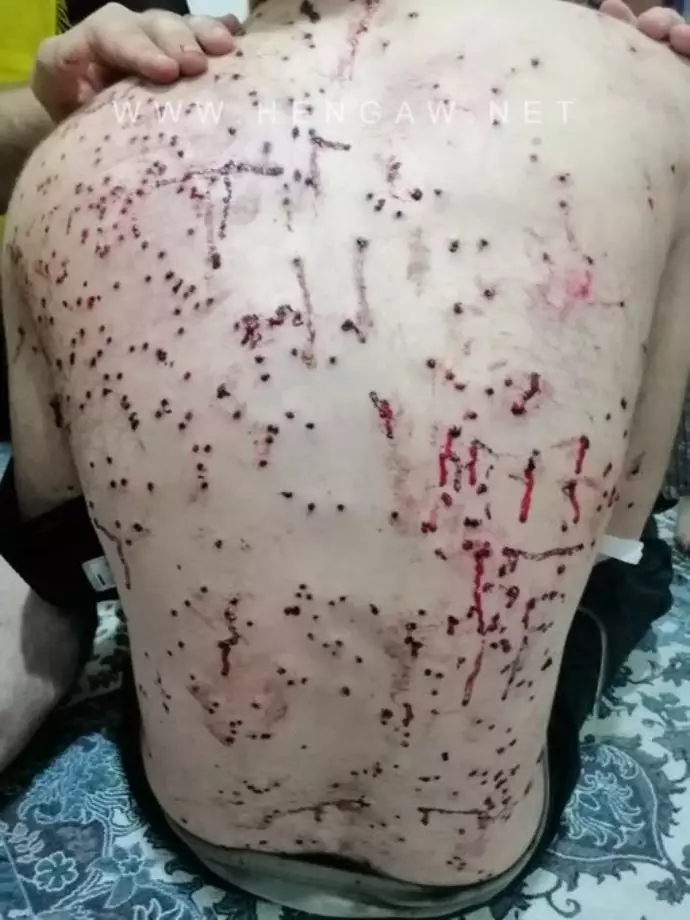 -نوجوان ۱۵ ساله مهابادی که مورد اصابت دهها ساچمه وحوش خامنه‌ای قرار گرفته است. 