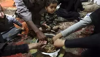 سوء تغذیه در ایران
