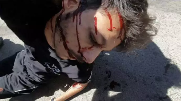 -تصویری از زخمی شدن یک جوان با شلیک وحوش علی خامنه‌ای در سقز