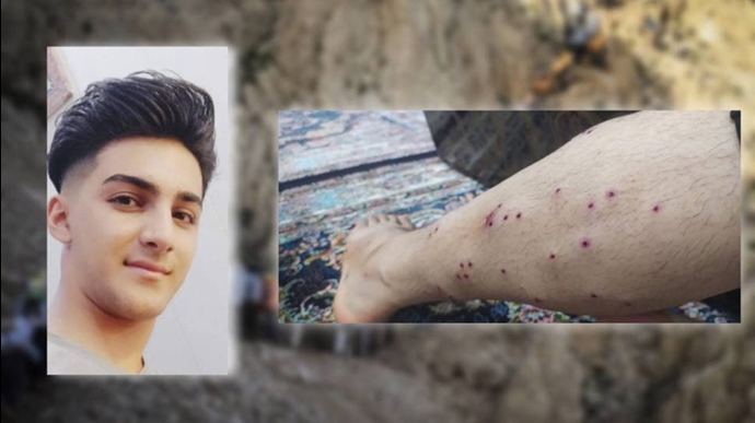 روز سه‌شنبه ١٩دیماه «یوسف چوپانی» ١٩ساله اهل سقز بر اثر شلیک مستقیم پاسداران خامنه‌ای از ناحیه پا مجروح شد. 