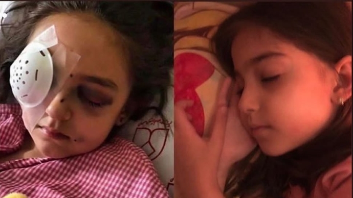 بیتا کیانی کودکی که در بالکن خانه‌شان مورد اصابت قرار گرفت و نابینا شد