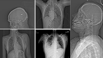 گاردین: تصاویر ایکس‌ری سرکوب قیام دیماه ایران