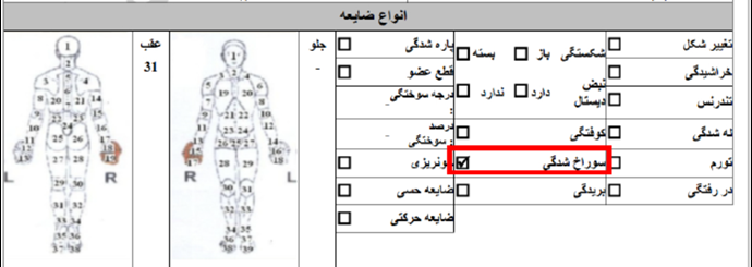 ۲۰- امیرعلی نجاتی مقدم ۱۹ ساله، تیرخوردگی (۱۹ دی) 